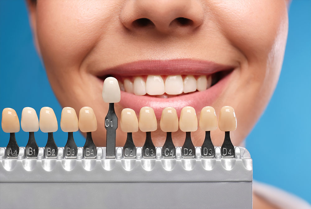 Crowns Veneers Prosthetics Bali