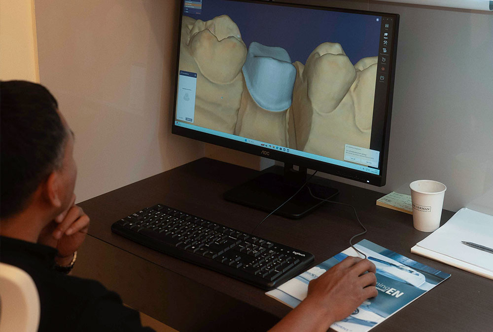 Advanced CBCT 3D dental diagnostics technology used at a modern dental clinic in Bali