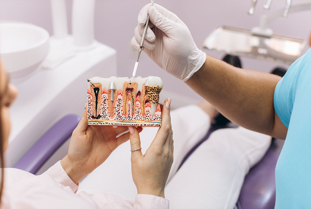 Root Canal Treatment Bali